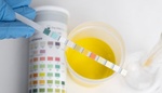Zjišťování pH půdy: Jak použít testovací soupravu