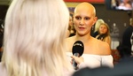 Bolestná zpověď mladé modelky Kláry: Alopecie ji připravila o vlasy i řasy