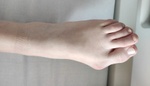 Vbočený palec: Krásné boty zanechají trvalé stoly